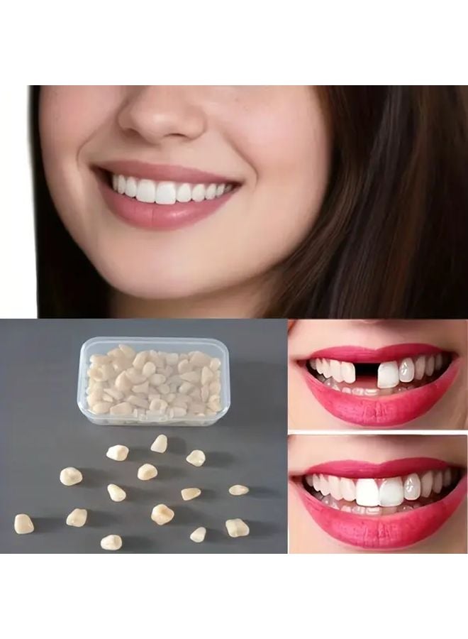 100 Pieces Temporary Veneers Set Front And Rear Teeth For Instant Smile Makeover - Image 3